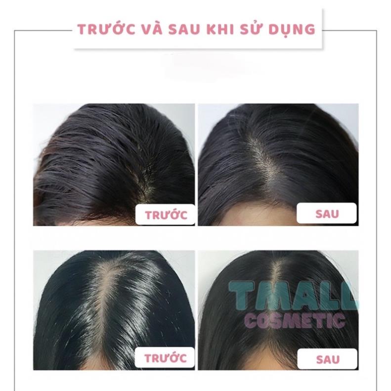 Dầu gội khô ISSY 150ml dạng xịt an toàn không cần nước dùng cho nam, nữ không bết tóc bodymist.tphcm