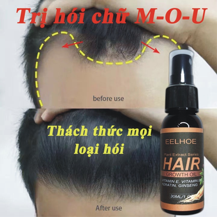 Xịt mọc tóc nhân sâm EELHOE giảm rụng tóc, kích mọc tóc, cải thiện hói đầu, ngăn nấm da đầu 30ml