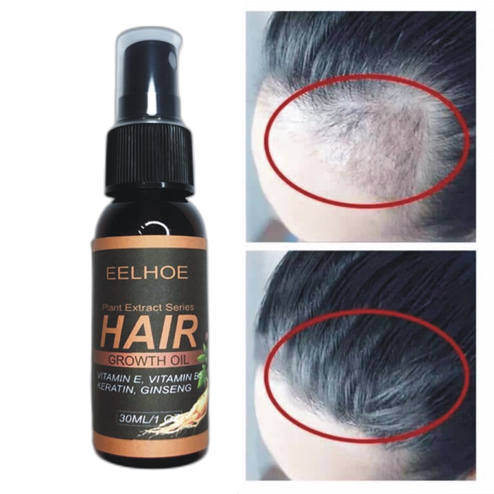 Xịt mọc tóc nhân sâm EELHOE giảm rụng tóc, kích mọc tóc, cải thiện hói đầu, ngăn nấm da đầu 30ml