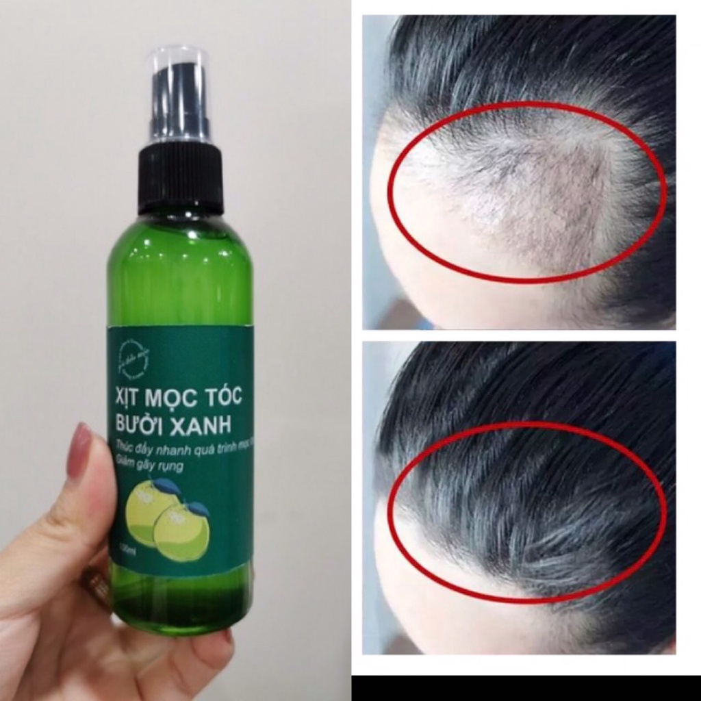 Xịt Tinh Dầu Bưởi Xanh- Kích Thích Mọc Tóc Ngăn Rụng Tóc 100ml_ XỊT MÓC TÓC CẤP TỐC CHỈ SAU 7 NGÀY SỬ DỤNG