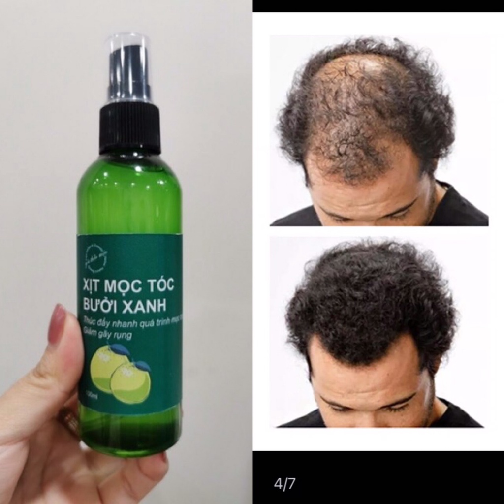 Xịt Tinh Dầu Bưởi Xanh- Kích Thích Mọc Tóc Ngăn Rụng Tóc 100ml_ XỊT MÓC TÓC CẤP TỐC CHỈ SAU 7 NGÀY SỬ DỤNG