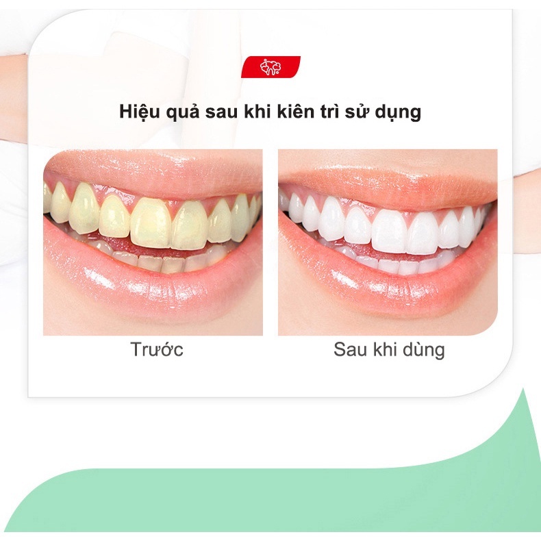 Kem Đánh Răng Làm Trắng Răng loại bỏ cao răng hôi miệng tẩy ố vàng Không Chứa Florua Kem đánh răng bạc hà 100g