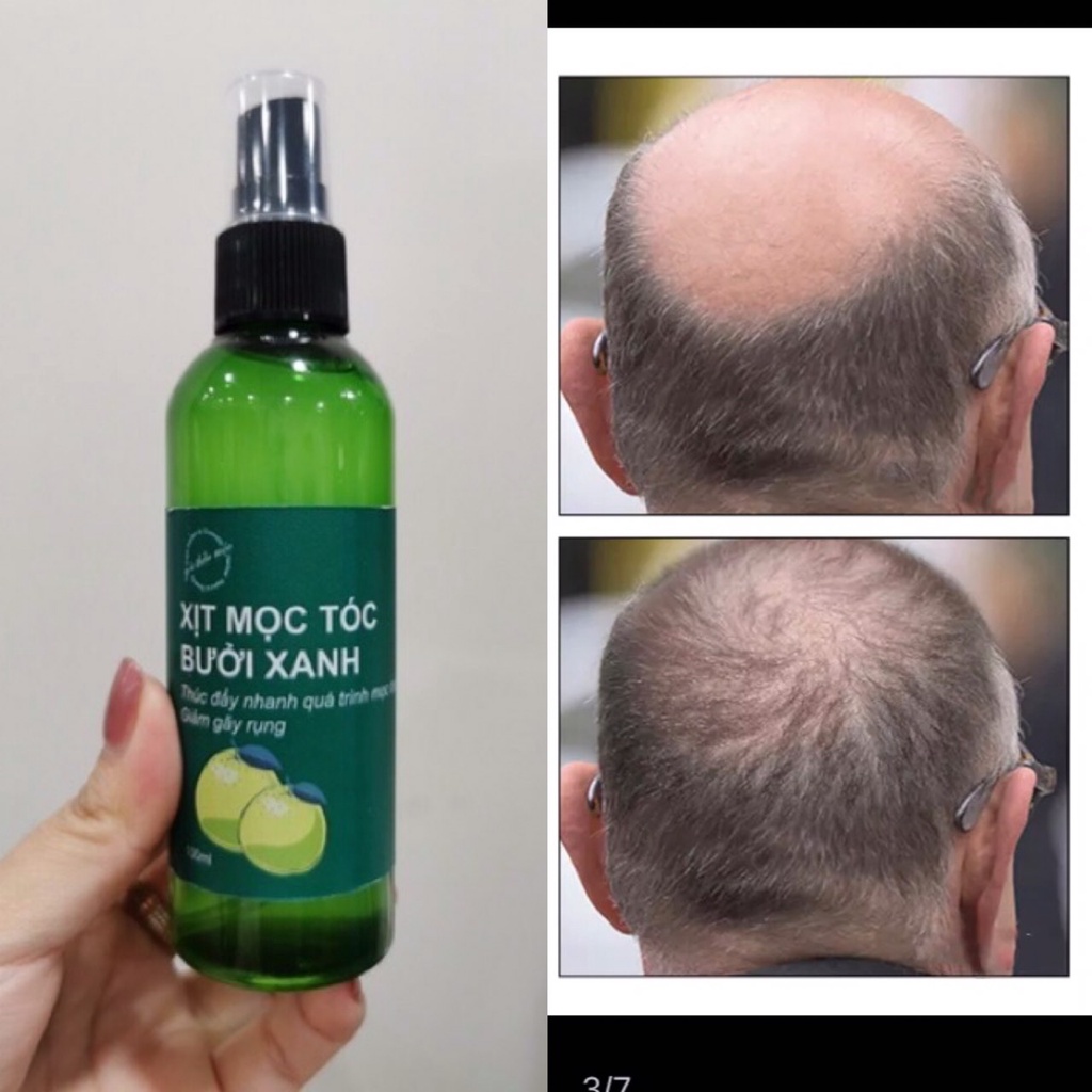 Xịt Tinh Dầu Bưởi Xanh- Kích Thích Mọc Tóc Ngăn Rụng Tóc 100ml_ XỊT MÓC TÓC CẤP TỐC CHỈ SAU 7 NGÀY SỬ DỤNG
