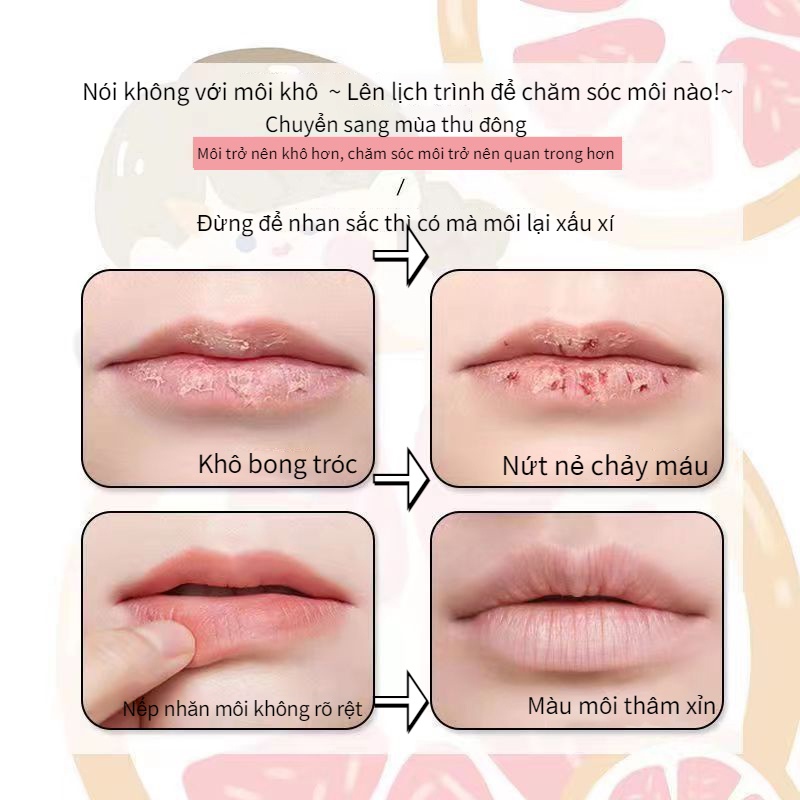 Vaseline Son dưỡng môi Tẩy da chết da khô môi nứt nẻ Dưỡng Ẩm Hiệu Quả Labocare Pantenolips chăm sóc môi