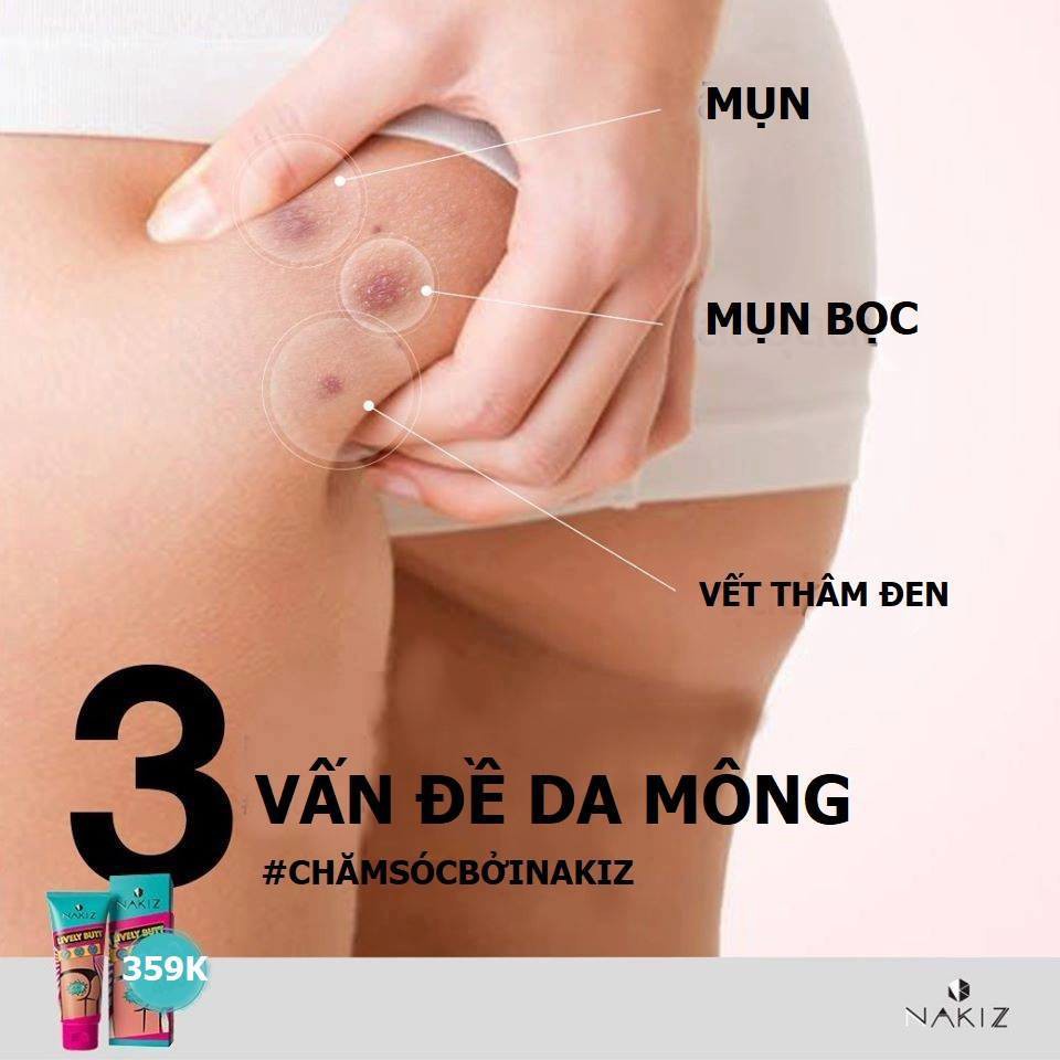 「?Nhà máy bán hàng trực tiếp」Kem thâm mụn, thâm mông, thâm nách, bẹn Nakiz Lively Butt – Mờ thâm đầu gối, cùi chỏ