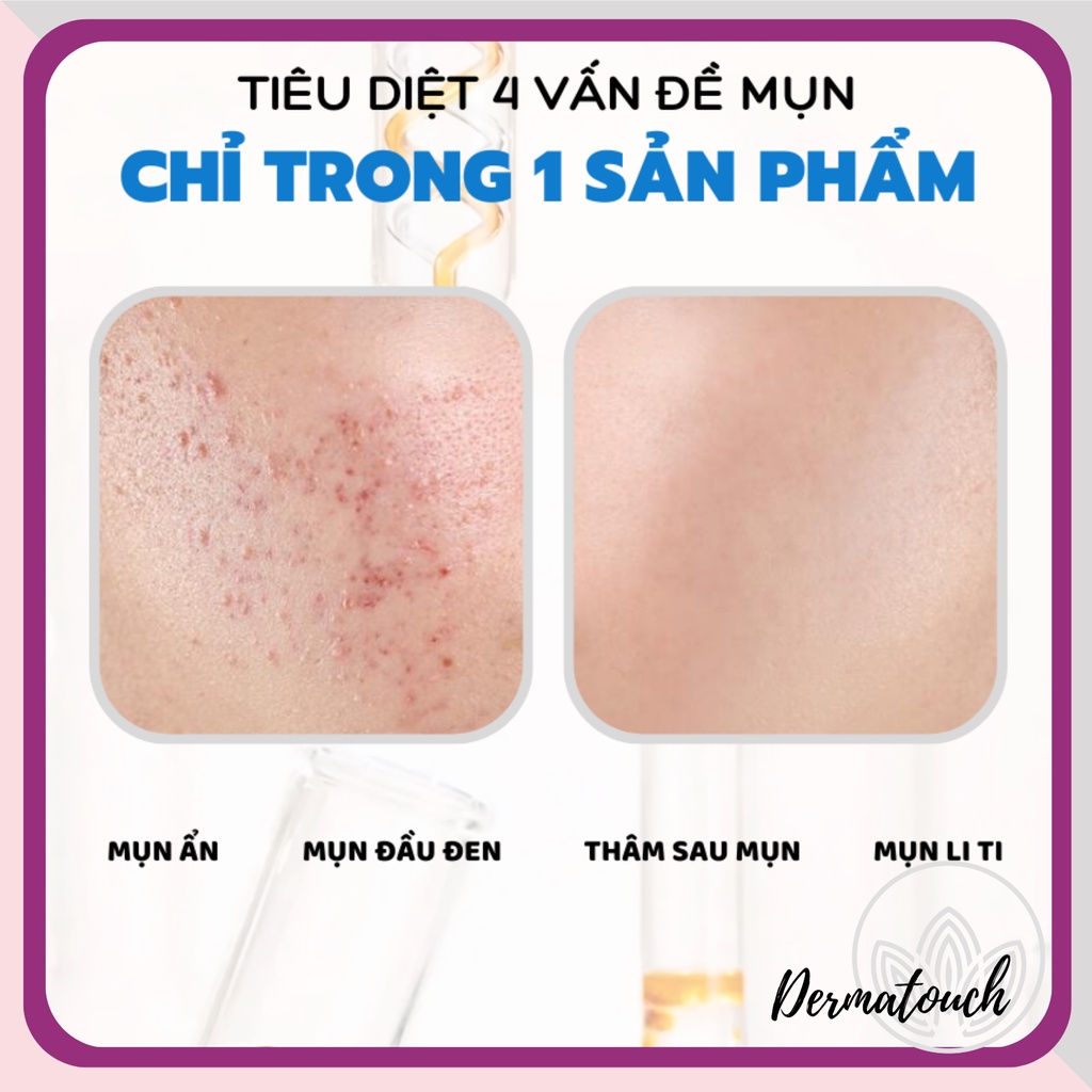 Actidem Gel bôi giảm mụn Actidem Derma Gel 18g mẫu mới, giảm mụn, mờ thâm – DMP chính hãng Tmedical