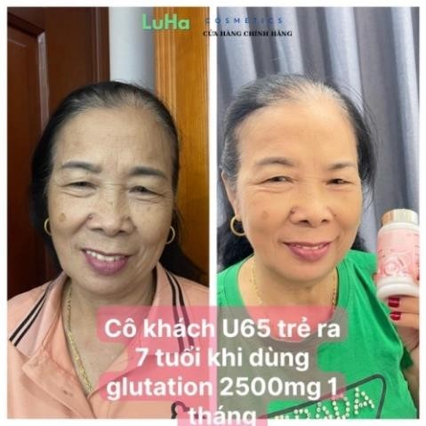 Viên ngậm Glutathione 2500, viên uống trắng da, mờ nám, hủy nám, cân bằng nội tiết tố nữ