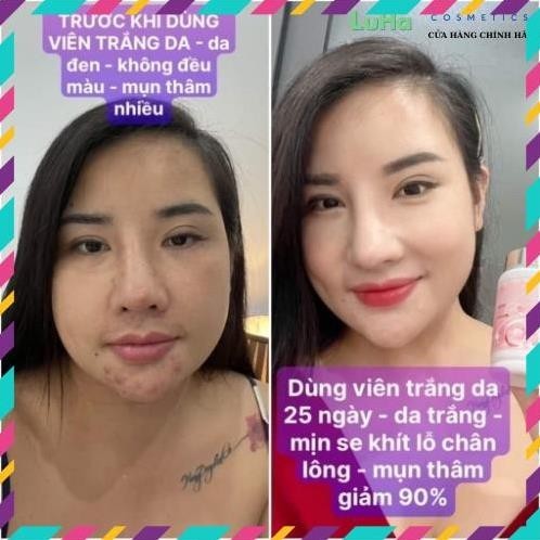 Viên ngậm Glutathione 2500, viên uống trắng da, mờ nám, hủy nám, cân bằng nội tiết tố nữ