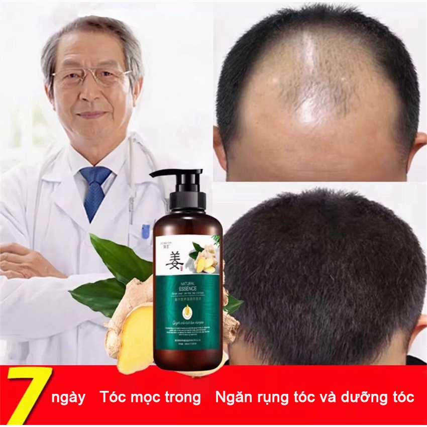 Dầu gội kích thích mọc tóc Dầu gội mọc tóc Giảm Gãy Rụng Dầu Gội Mọc Tóc Nhanh kiểm soát dầu loại bỏ gàu