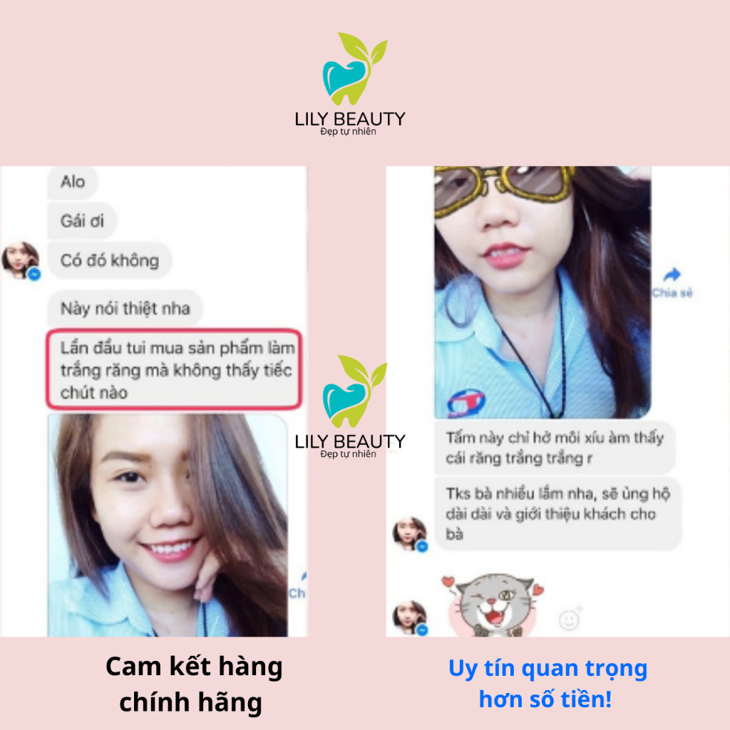 Miếng dán trắng răng Crest Professional Effects Combo 7 gói  – Giúp răng trắng sáng tự nhiên