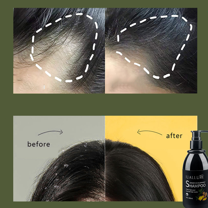 Dầu gội mọc tóc Dầu gội kích thích mọc tóc dầu gội chống rụng tóc 200ml ngăn rụng tóc thoát khỏi
