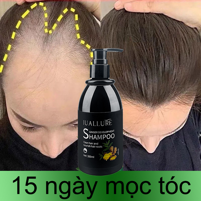 Dầu gội mọc tóc Dầu gội kích thích mọc tóc dầu gội chống rụng tóc 200ml ngăn rụng tóc thoát khỏi