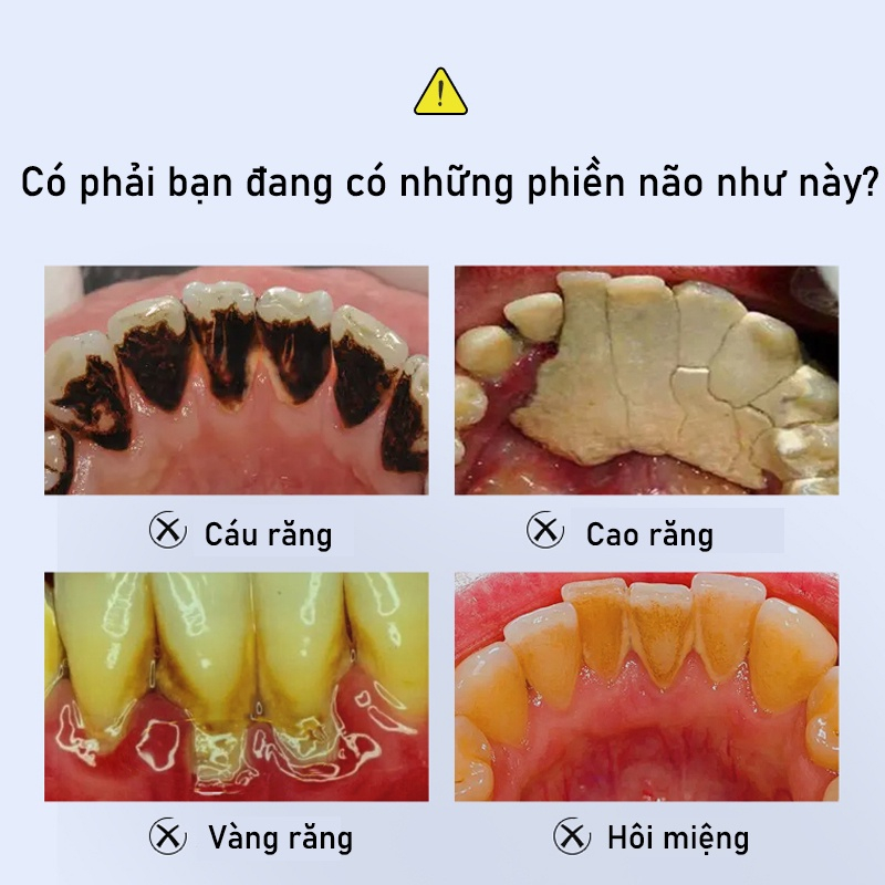 Kem đánh răng bạc hà 100g loại bỏ cao răng hôi miệng tẩy ố vàng Kem đánh răng làm trắng răng