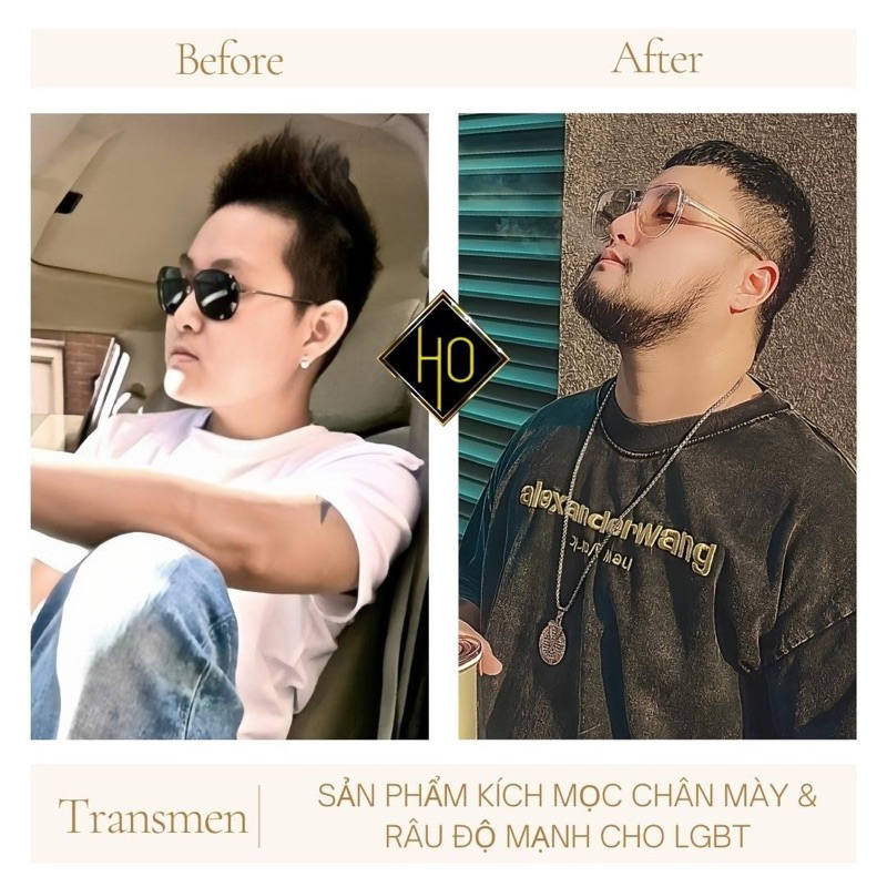 ?Kích Mọc Chân Mày & Râu Cao Cấp X3plus 20% Độ Mạnh Nhất