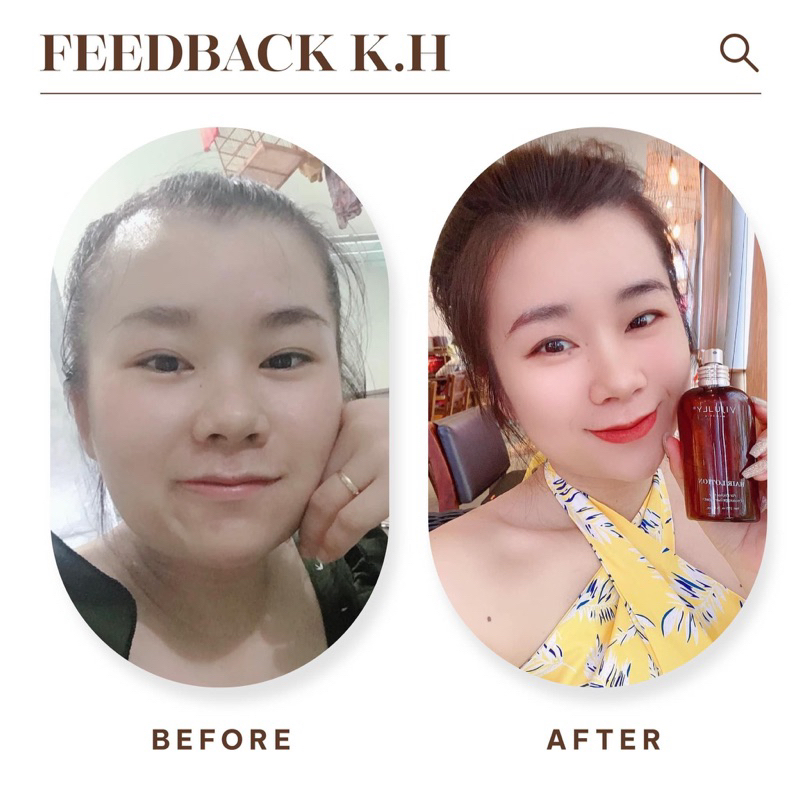 Xịt dưỡng tóc Tinh Dầu Bưởi ViJully 150ml (Chính hãng)