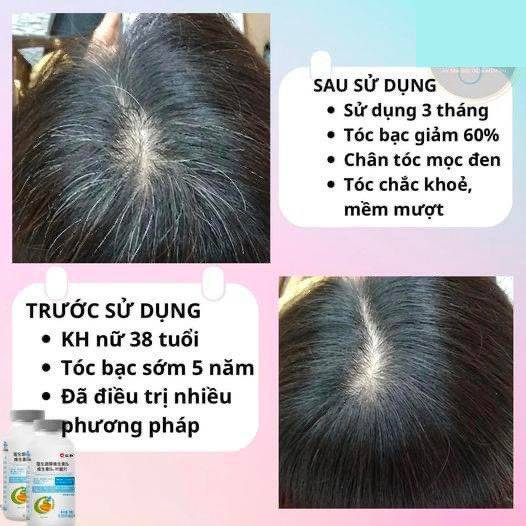 Viên uống cải thiện tình trạng tóc bạc sớm nội địa Trung
