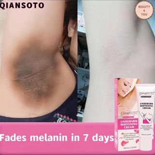 QIANSOTO Kem Giảm Thâm Nách Mông Làm Trắng Da Dưỡng Ẩm Khử Mùi Hôi