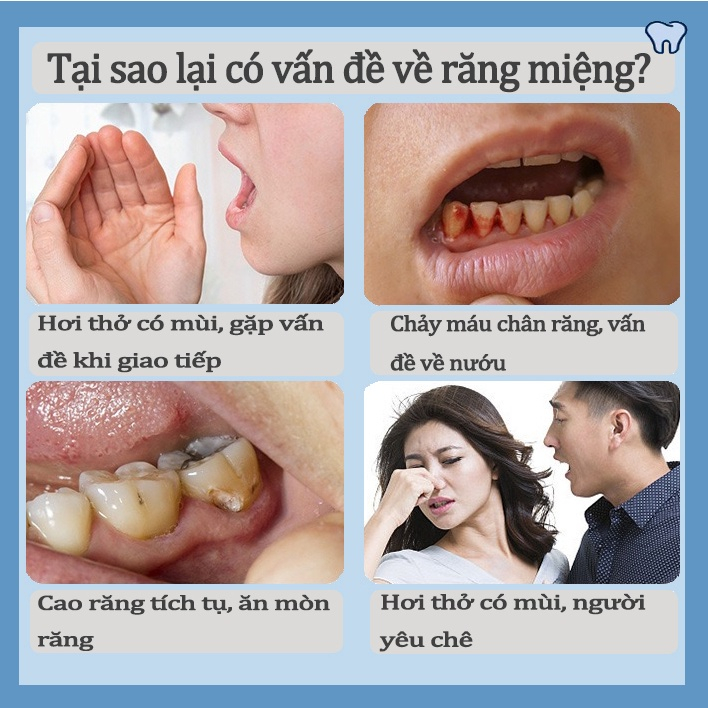 Kem Đánh Răng Làm Trắng Răng Giảm Vết Ố Vàng Trên Răng giảm sâu răng Giữ Hơi Thở Thơm Mát 250g