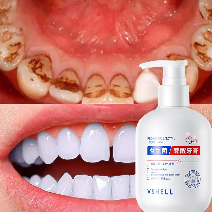 Kem Đánh Răng Làm Trắng Răng Giảm Vết Ố Vàng Trên Răng giảm sâu răng Giữ Hơi Thở Thơm Mát 250g