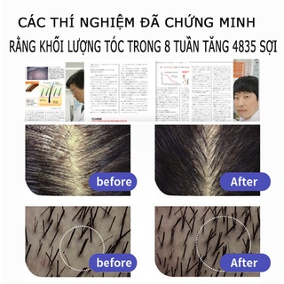 Dầu Gội Gừng Mọc Tóc đầu làm rậm tóc kiểm soát dầu loại bỏ gàu 400ml Kích thích mọc tóc tươi dầu gội chống rụng tóc