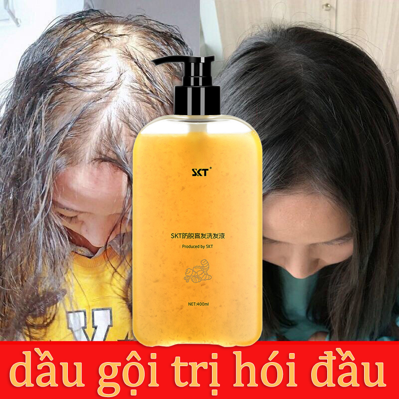 Dầu Gội Gừng Mọc Tóc đầu làm rậm tóc kiểm soát dầu loại bỏ gàu 400ml Kích thích mọc tóc tươi dầu gội chống rụng tóc