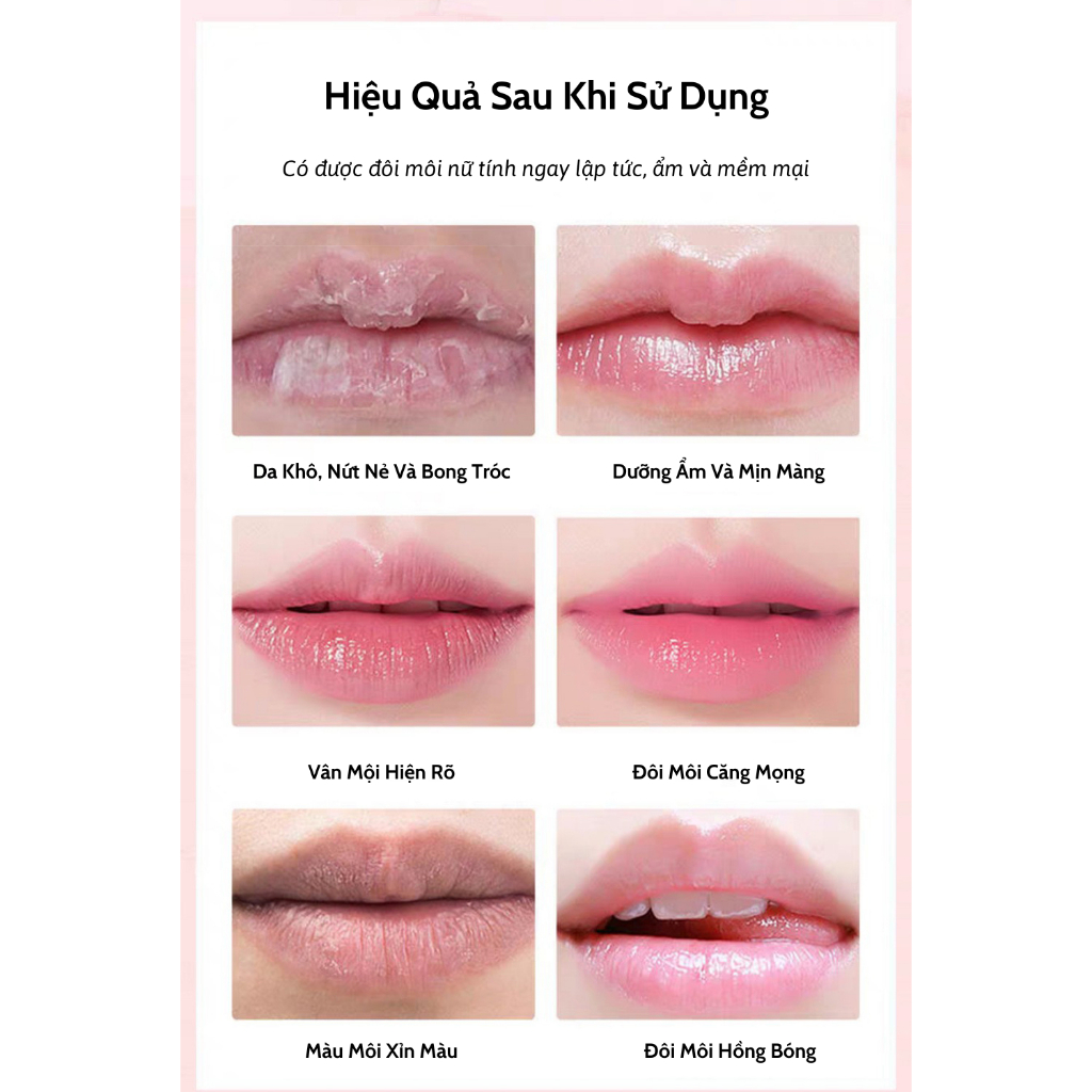 Mặt Nạ Ủ Môi Dưỡng Hồng KISS PONY Giúp Môi Căng Mọng, Mềm Mịn, Tẩy Da Chết Cho Môi – Bitishop