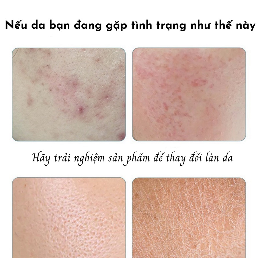 Mặt Nạ Dưỡng Da, Mặt Nạ Dưỡng Trắng Cấp Ẩm Mờ Thâm Bổ Sung Collagen Tinh Chất Ốc Sên