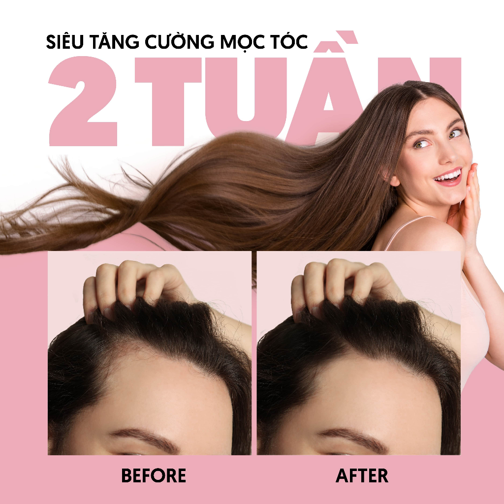 [MUA 1 TẶNG 1] Xịt Dưỡng Tóc Biotin & Keratin Phục Hồi Tóc 4% Hỗ Trợ Mọc Tóc MILAGANICS 150ml (Chai)