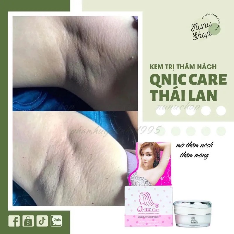 Kem Giảm Thâm Nách QNIC CARE, Thâm Mông, Đầu Gối, Khuỷu Tay Q-NIC CARE- 15Gr, Chính Hãng Thái Lan