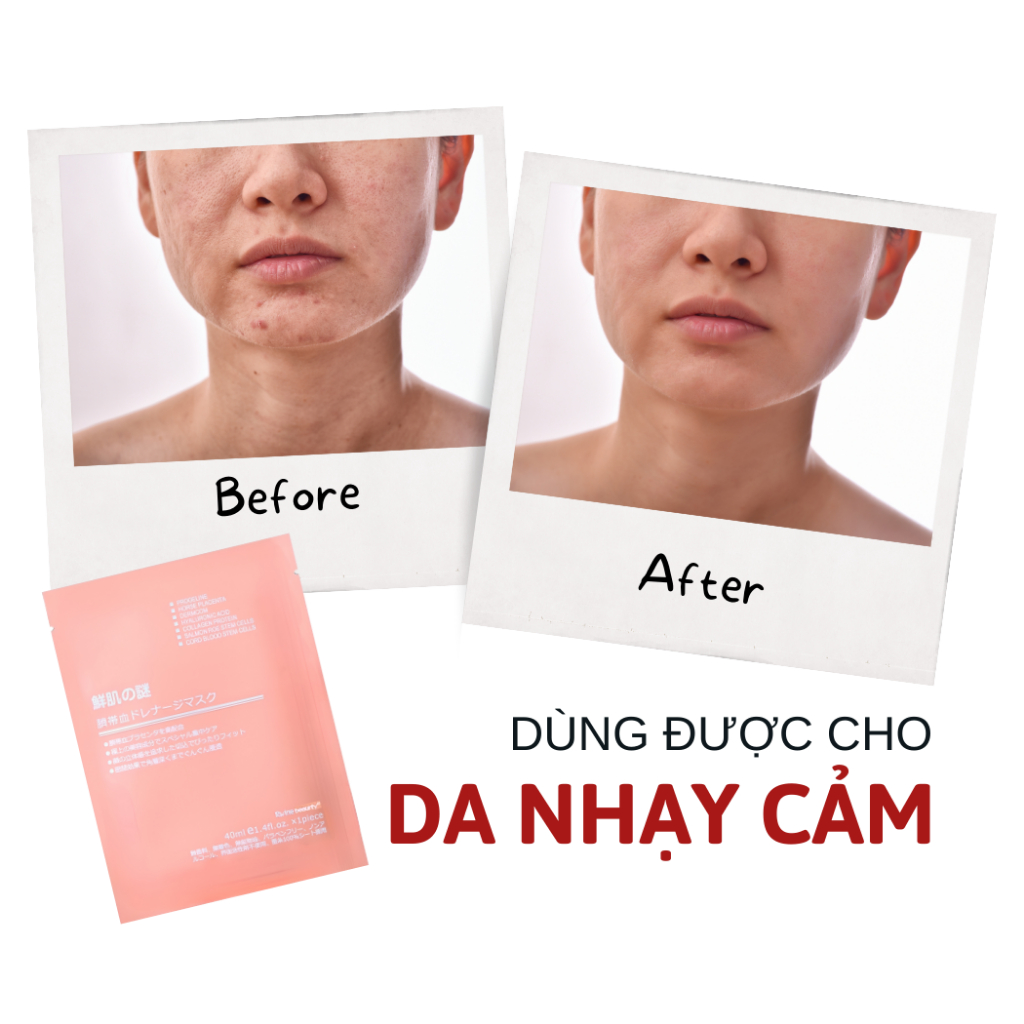 Combo 100 Mặt Nạ Nhau Thai Cừu, 2 Hộp Set 50 Miếng Mask Giấy Dưỡng Trắng Da Mặt Cấp Ẩm Tái Tạo Collagen Phục Hồi 40ml