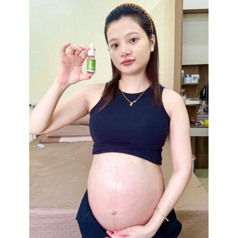 [MẪU MỚI 2024] SERUM MỤN DIẾP CÁ IGREEN – GIẢM MỤN ẨN, MỤN VIÊM, MỤN TRỨNG CÁ,…GIẢM THÂM, SE KHÍT LỖ CHÂN LÔNG