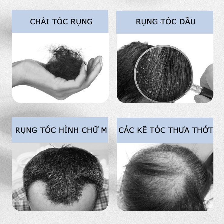Dầu gội kích thích mọc tóc Dầu gội mọc tóc Giảm Gãy Rụng nơi rụng tóc Nhanh kiểm soát dầu loại bỏ gàu