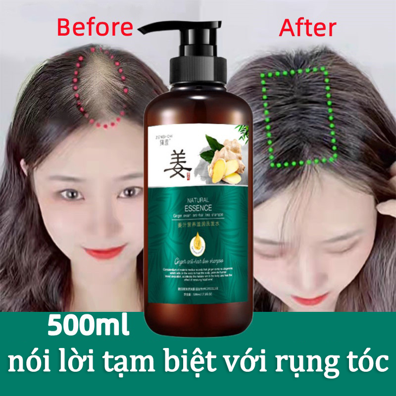 Dầu gội kích thích mọc tóc Dầu gội mọc tóc Giảm Gãy Rụng nơi rụng tóc Nhanh kiểm soát dầu loại bỏ gàu