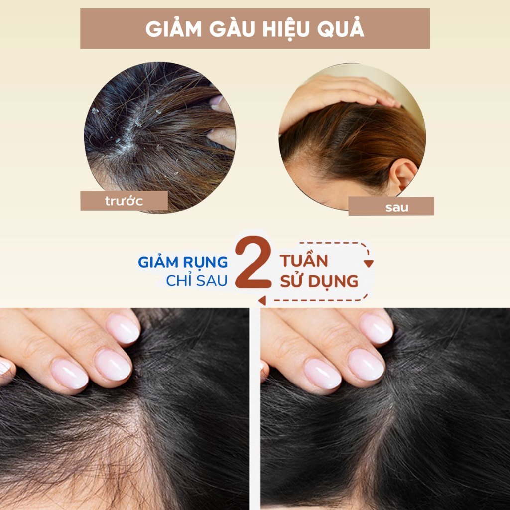 Bộ dầu gội xả bồ kết, vỏ bưởi Mộc Xưa 500ml ngăn ngừa rụng tóc, kích thích mọc tóc, nuôi dưỡng chân tóc chắc khỏe