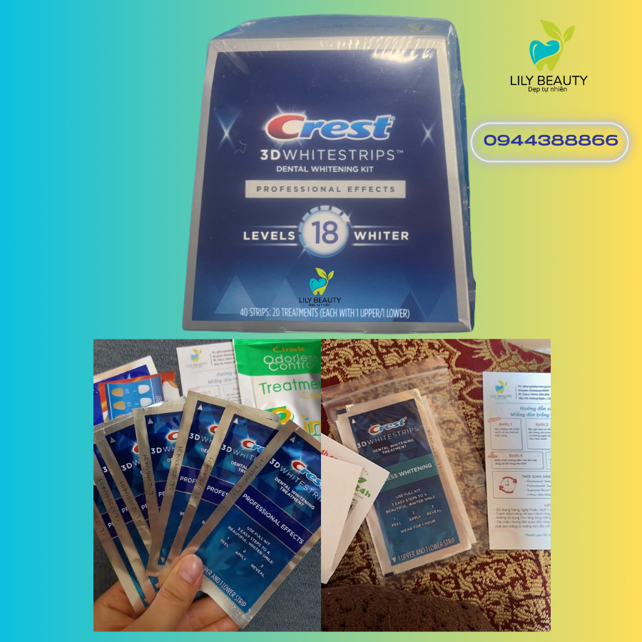 Miếng dán trắng răng Crest Professional Effects Combo 7 gói  – Giúp răng trắng sáng tự nhiên