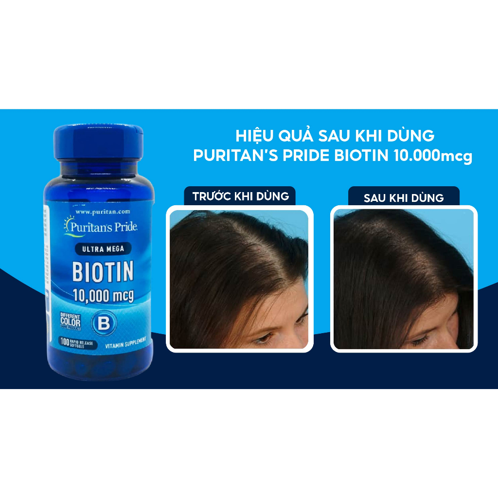 Viên uống giúp mọc tóc, giảm rụng tóc Puritan’s Pride Ultra Mega Biotin 10000 mcg 100 viên của Mỹ
