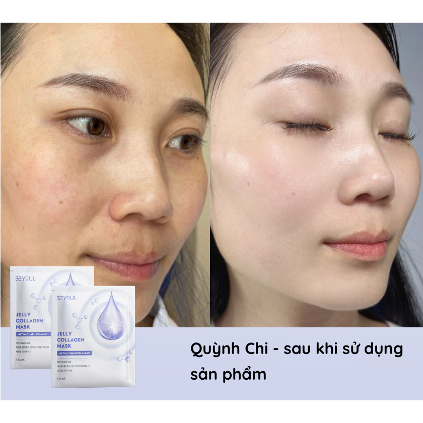 Mặt nạ thạch Collagen Seyoul Hàn Quốc, Jelly Collagen Mask Dưỡng Trắng Cấp ẩm Da Căng Bóng Mịn Màng 1 Hộp x 5 miếng