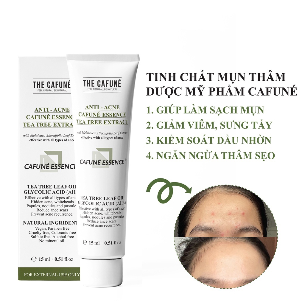 Kem Giảm Mụn Và Giảm Thâm Cafuné Essence 15gram chính hãng