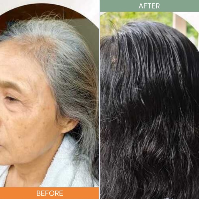 DẦU GỘI PHỦ BẠC LACO ORGANIC NANO NHANH HIỆU QUẢ CHỈ SAU 9 PHÚT KHÔNG LOANG KHÔNG RÁT DA ĐẦU ( CHÍNH HÃNG )