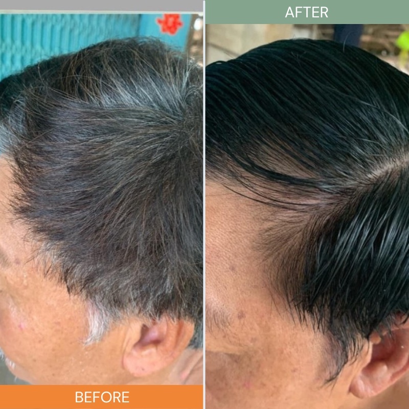 DẦU GỘI PHỦ BẠC LACO ORGANIC NANO NHANH HIỆU QUẢ CHỈ SAU 9 PHÚT KHÔNG LOANG KHÔNG RÁT DA ĐẦU ( CHÍNH HÃNG )