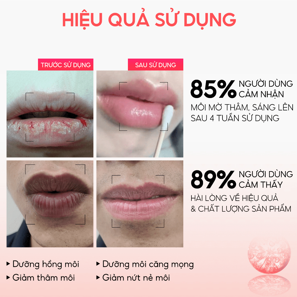 Serum hồng môi khử thâm Belina Abera 20ml – Dưỡng môi hồng căng bóng tự nhiên, giảm thâm môi, khô môi nứt nẻ nhanh chóng