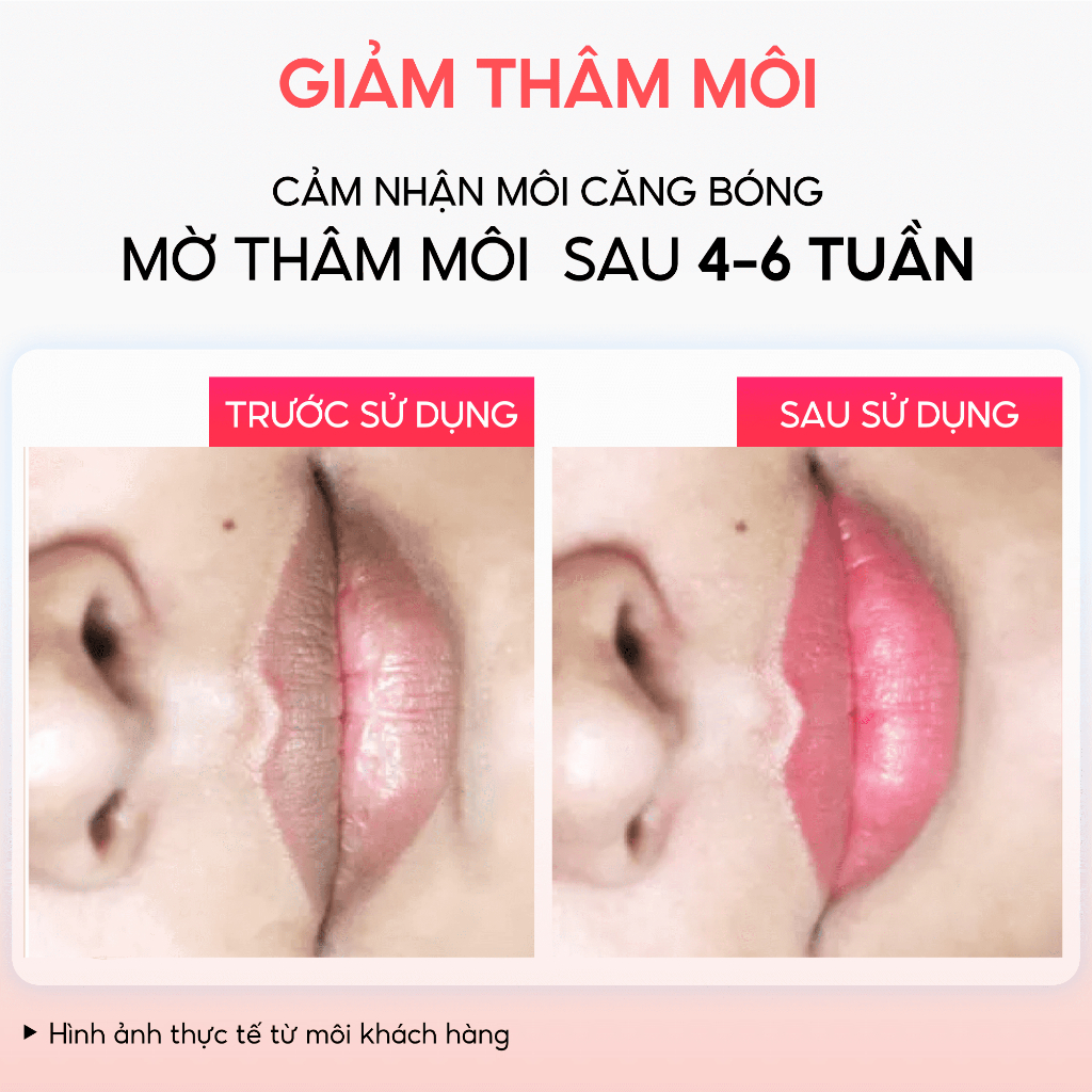 Serum hồng môi khử thâm Belina Abera 20ml – Dưỡng môi hồng căng bóng tự nhiên, giảm thâm môi, khô môi nứt nẻ nhanh chóng