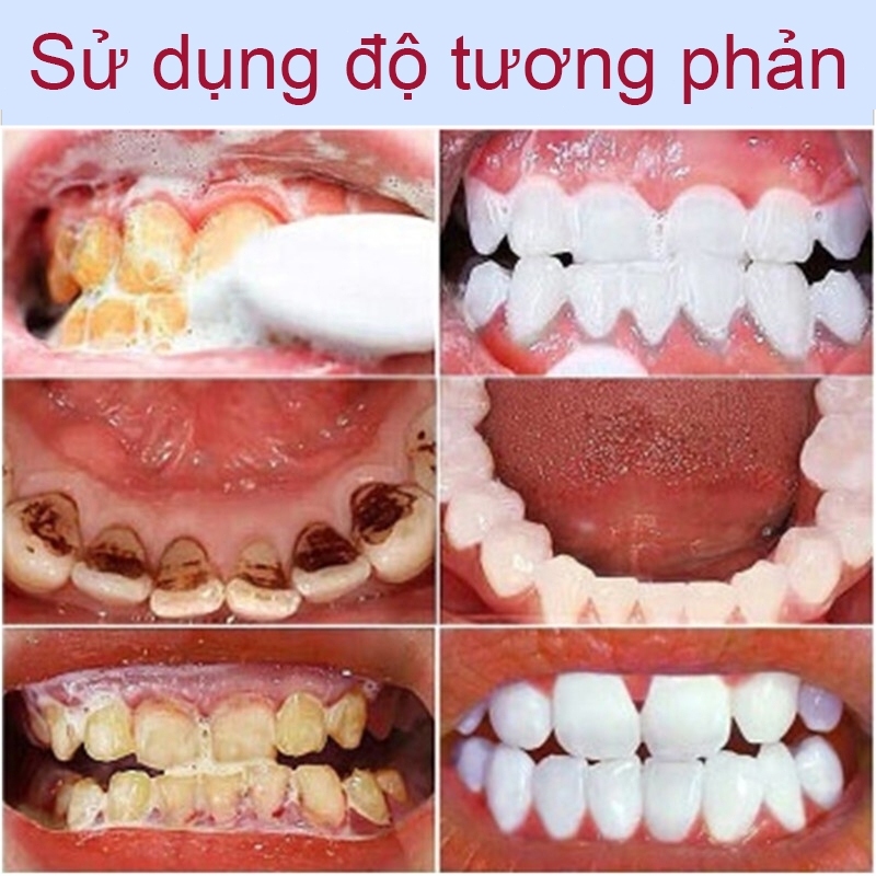 Gel nano bạc GAOLIBAI đánh bật cao răng sạch mảng bám trắng răng cho hơi thở thơm mát, GAOLIBAI chính hãng 120g kem đánh
