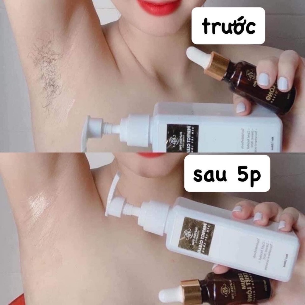 Combo Kem tẩy lông Huyền Phi + Serum triệt, tẩy được lông tay chân nách vùng kín an toàn mọi loại da 140ml – vnmask