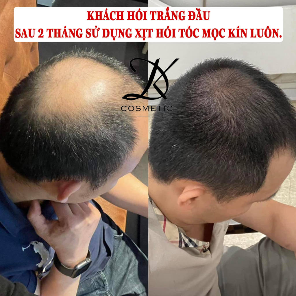 Serum Tóc Mostal Solution, Xịt tóc dưỡng tóc chắc khoẻ Duongkiu Cosmetic