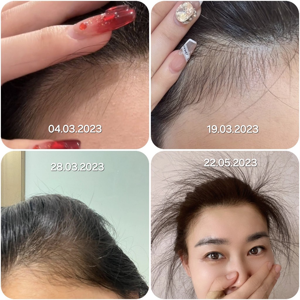Xịt bưởi kích mọc tóc giảm rụng tóc VƯỜN NHÀ CỘI dưỡng tóc chuyên sâu 100ml