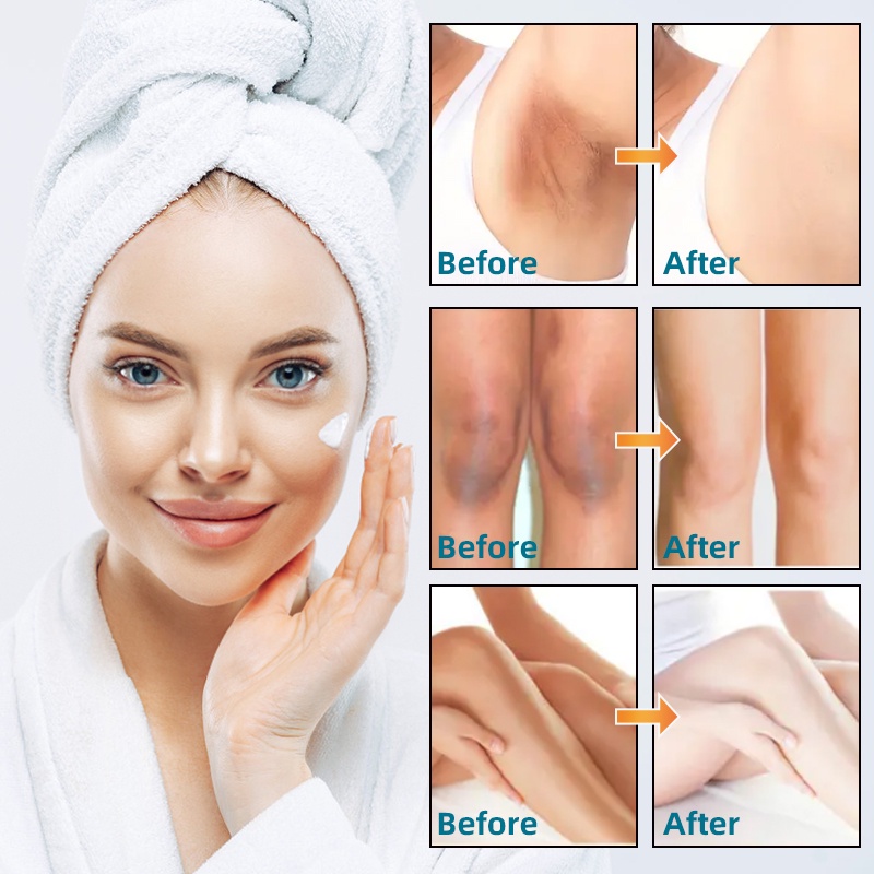 Mô tả RUOALL Tinh Chất Salicylic Acid 2% Tẩy Tế Bào Chết Làm Sạch Lỗ Chân Lông Và Nếp Nhăn Cho Da Mặt 50g - 6