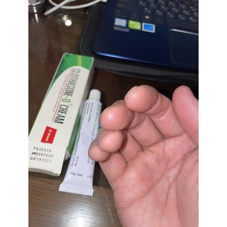 [Chỉ Bán Hàng Thái] Kem giảm nấm móng CLOTHASONE-D Cream 15 gram Thái Lan