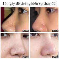 Sữa Rửa Mặt Dưỡng Ẩm IMAGES Kiềm Dầu Làm Sạch Sâu