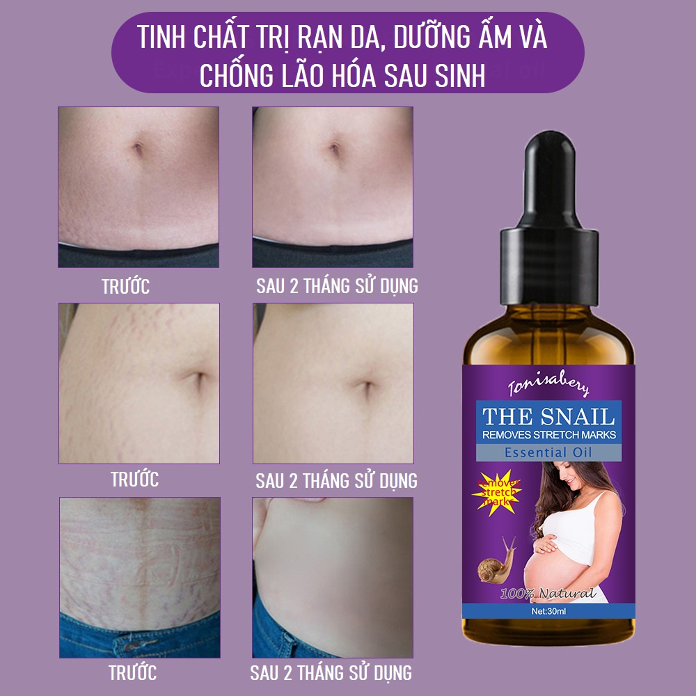 Tinh Chất Ốc Sên THE SNAIL REMOVES STRECH MARKS Giảm Sẹo Làm Mờ Vết Rạn Da, Vết Nám, Tàn Nhang, Dưỡng Trắng Da